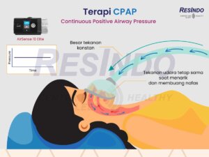 cara-kerja-mesin-CPAP